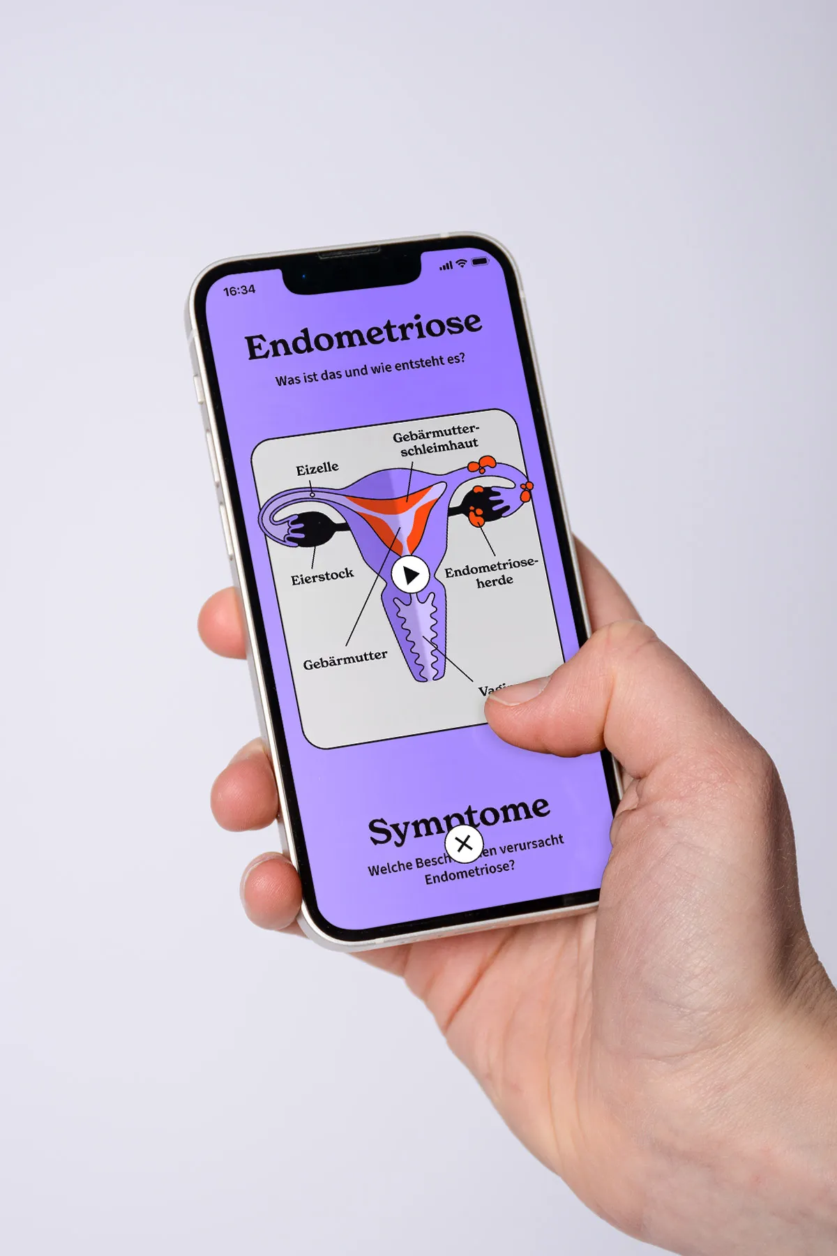 Endo